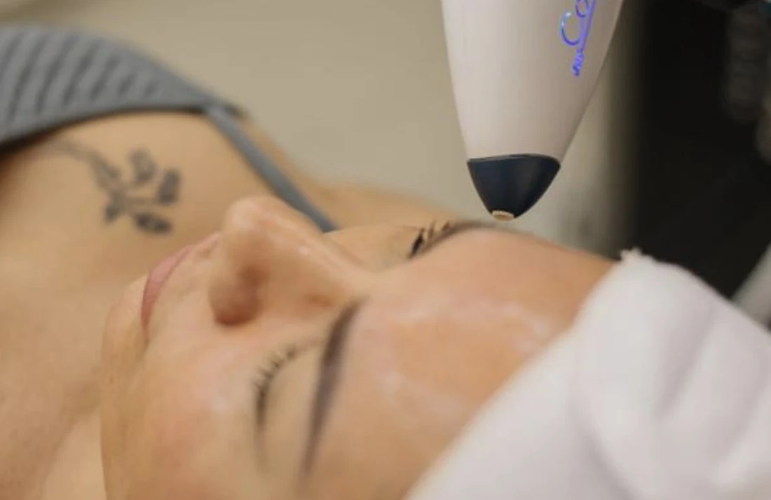 Dr. Sibaja delivering Coolifting to a patient's face