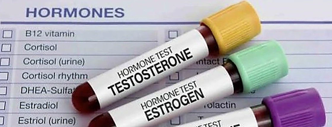 Análisis hormonales — testosterona, estrógeno y progesterona
